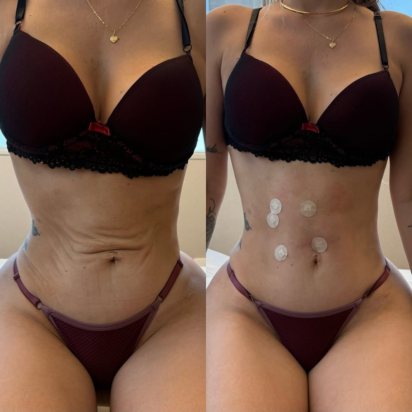 Resultado clínico 01, comparação fotográfica lado a lado