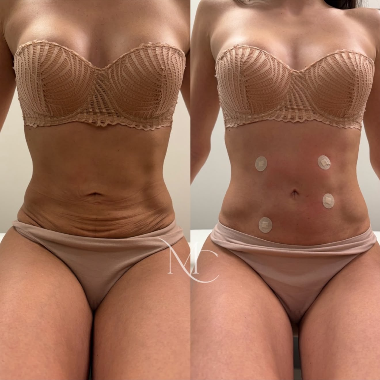 Resultado clínico 02, comparação fotográfica lado a lado