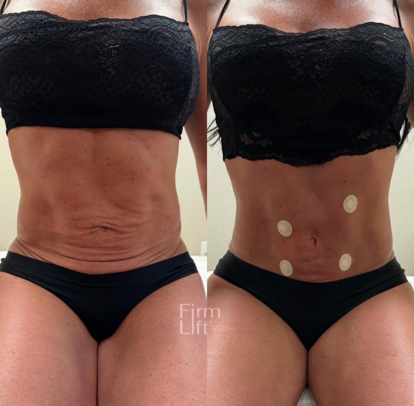 Resultado clínico 03, comparação fotográfica lado a lado